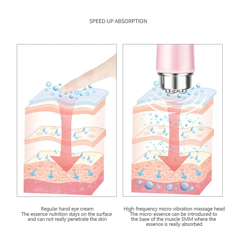 4-in-1 elektrisches Gesichtsmassagegerät, Mikrovibration, Augenschönheitsinstrument zum Entspannen von Augen, Augenringen, Tränensäcken, Falten und Schwellungen